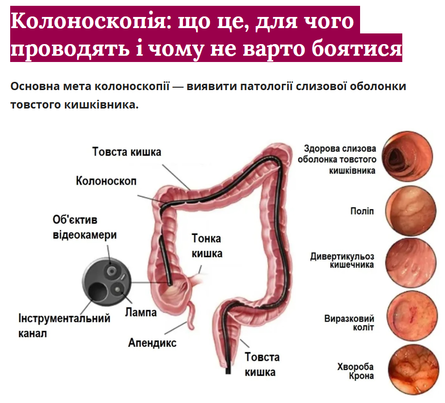 Колоноскопія: що це, для чого проводять і чому не варто боятися