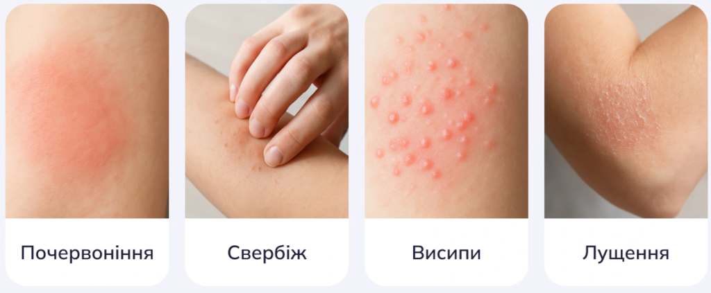 як виглядає алергія на шкірі
